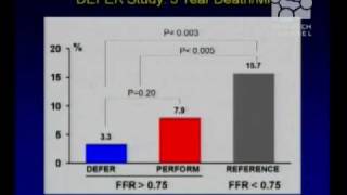 Who Needs a Coronary Artery Stent [upl. by Heydon395]