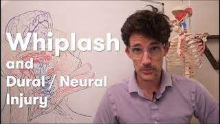 Whiplash and DuralNeural injury [upl. by Marek496]