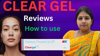 Clear gel pimples or acne treatments kaise use karte hai precautions iske substitute side effects [upl. by Tacita197]