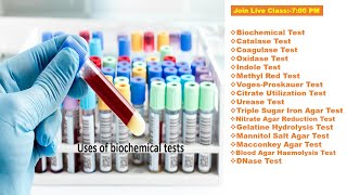 Biochemical TestCatalase Test Coagulase Test Oxidase Test Indole Test Methyl Red Test etc [upl. by Lerner256]