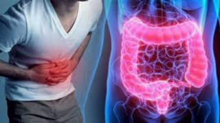 DIARREA CRÓNICA Y DOLOR ABDOMINAL PUEDEN SER SÍNTOMAS DE ENFERMEDAD INFLAMATORIA INTESTINAL [upl. by Husha]