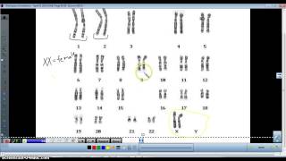 Karyotype analysis [upl. by Ldnek]