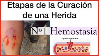 Fases de Cicatrización de las heridas [upl. by Annoed]