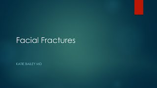 Facial fractures [upl. by Kirby812]