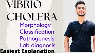 Vibrio Cholera  Vibrio Cholera Microbiology [upl. by Oneill]