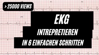 EKG interpretieren in 6 Schritten [upl. by Dieball]