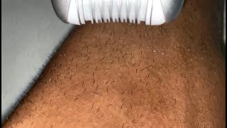 EPILATING THICK LEG HAIR [upl. by Jerrome473]