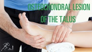 Osteochondral lesion of the talus OCD lesion Signs symptoms and treatment options [upl. by Hgielyak]