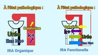 IRA Fonctionnelle et Organique Bilan Rénal  Urée Creatinine Kaliémie Natremie [upl. by Yllet]