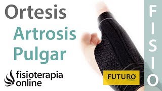 Artrosis del pulgar  Cómo cuándo y por qué utilizar ortesis [upl. by Aihtnis]