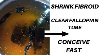 SHRINK FIBROID Clear Fallopian TubeCONCEIVE FAST HOW To Shrink Fibroid Fast And Conceive [upl. by Yleak]