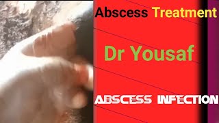 Large Abscess In Dairy Cow With A Lot Of Pus See Vet Doctor Help [upl. by Anot153]