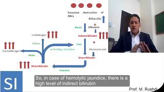 Laboratory diagnosis of jaundice [upl. by Flanders]