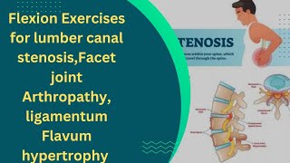 Flexion Exercises For lumber Canal stenosisFacet Joint Arthropathy ligamentum Flavum Hypertrophy [upl. by Latini]