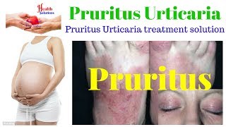 Pruritus  Pruritus Urticaria  Pruritus Urticaria Treatment Solution [upl. by Sheelah]