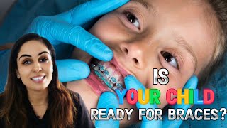 Age for Orthodontics on Teeth Talk with Dr Swati Maan [upl. by Zeeba]