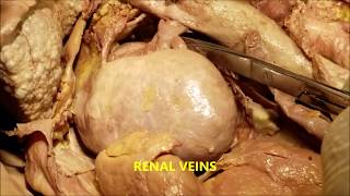 KIDNEY Fascia Morphology Structure Vessels and Clinical Aspects – Sanjoy Sanyal [upl. by Aneev28]