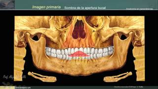 Estructuras anatómicas en la radiografía panorámica II [upl. by Sirrap]