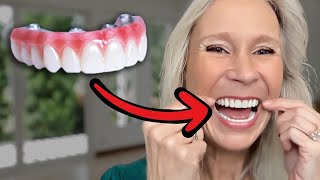 5 Things I Wish Id Known Before Dental Implants [upl. by Ifen668]