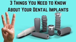 3 things you need to know about your dental implants [upl. by Ludwig]