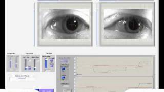 Eye Video Saccade Horizontalwmv [upl. by Florenza667]