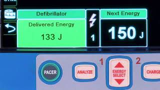 X Series® Advanced Defibrillation English [upl. by Yenaled]