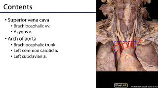 Superior Mediastinum [upl. by Carolyne34]