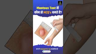 Mantoux Test क्या है और कैसे करते है  Tuberculin Skin Test Mantoux Test Results Reading shorts [upl. by Diraf]