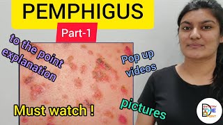 SKIN LESIONS PEMPHIGUS PART1 [upl. by Nyrret913]