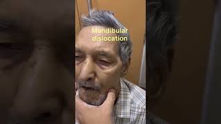 Temporomandibular TMJJoint Dislocation Reduction Technique Mandibular dislocationJaw dislocation [upl. by Ati412]