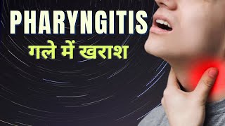 pharyngitis MSN in hindi  pharyngitis throat infection treatment in hindi  sore throat [upl. by Adnaw]