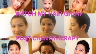 Hairgrowth PostChemotherapy  Young women with Breast Cancer [upl. by Bax]