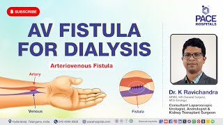 AV Fistula Surgery  AV Fistula for Dialysis  Procedure Uses Benefits amp Complications [upl. by Sadowski]