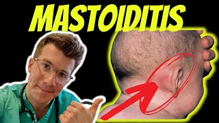 Doctor ODonovan explains Mastoiditis  including anatomy symptoms diagnosis and treatment [upl. by Nolad]