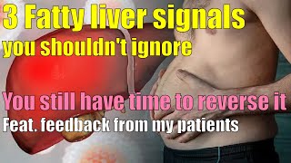 Fatty Liver 3 Symptoms Solutions amp Supplements Revealed Feat real feedback from my patients [upl. by Lyudmila]