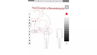 Decorticación y Descerebración Fisiopatología [upl. by Terti]