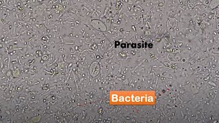 Bacteria and Parasites in stool Microscopy Live motile bacteria and cysts of Giardia lamblia [upl. by Nylirehc]