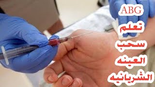 ABGسحب دم من الشريانغازات الدم arterial blood gases with Alans test NOURELDEN NE [upl. by Aeiram968]