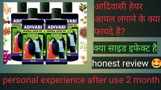 100 original ADIVASI Hair Oil Honest review with LIVE RESUL। मेरे बालों का क्या से क्या हाल बना😱 [upl. by Nelyahs62]