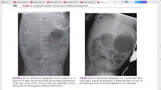 EMERGENCY RADIOLOGY REQUISITES [upl. by Oidgime]