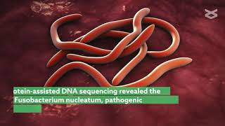 Bacteria alter cancer suppressor genes in colorectal cancer [upl. by Bunting252]