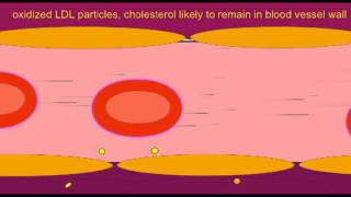 HEART DISEASE OXIDIZED LDL PARTICLES [upl. by Agnella]