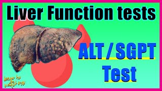 Alanine aminotransferase ALT test SGPT Alt test Results amp Interpretation  Liver function test [upl. by Roche]