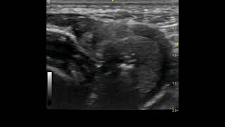 Canine cricopharyngeal achalasia botox injection [upl. by Mccourt]