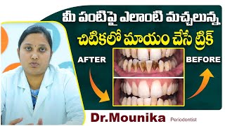 పంటిపై మచ్చలు పోవాలంటే  How To Remove Stains From Teeth In Telugu  Eledent Dental Hospitals [upl. by Boylan344]