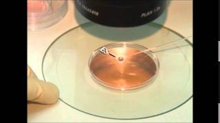 vitrification of embryos and oocytes [upl. by Abehsile323]