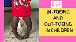 why childrens feet face funny directions [upl. by Marva]