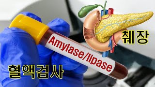 혈액검사  Amylase Lipase  췌장수치 [upl. by Oneill]