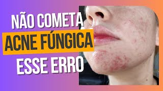 Escolhendo o melhor tratamento para acne fúngica  Comparação Peróxido de Benzoíla e Ácido Azelaico [upl. by Eerahs]