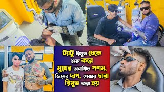 Tattoo Remove Center Dhaka🔥Tattoo Remove  Laser Tattoo Removal Works  Tattoo Remove Shop In Dhaka [upl. by Breban]